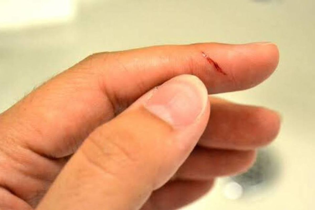A doctor finally explains the age-old question: Why do paper cuts